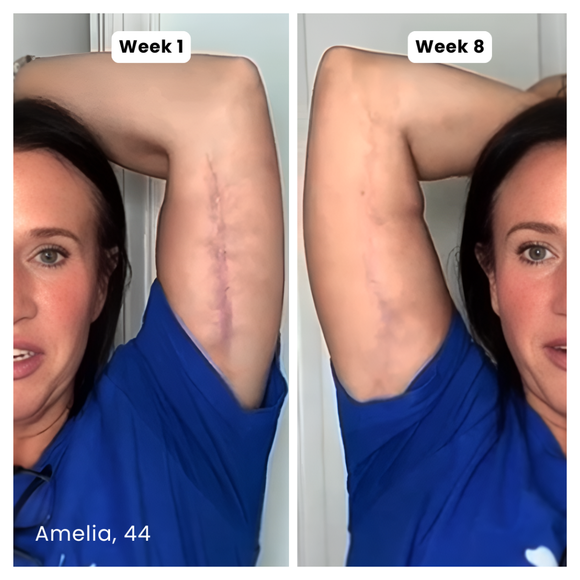 Feature product image