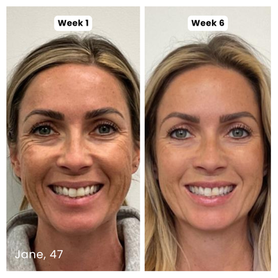 Anti-Aging Silicone Scar-Stick