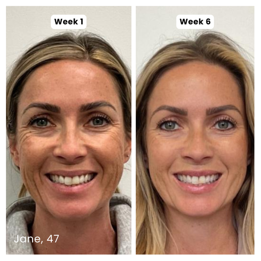 Anti-Aging Silicone Scar-Stick