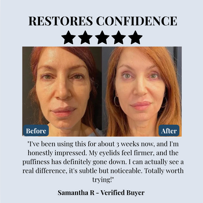 Lid Lifting Treatment