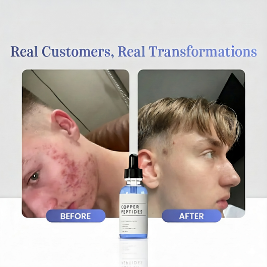 GHK-Cu Peptides Serum